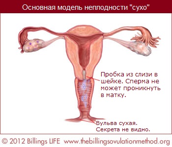 Basic Infertile Pattern of Dryness
